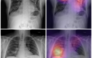 AI Algorithm May Lead to Faster X-Ray Review