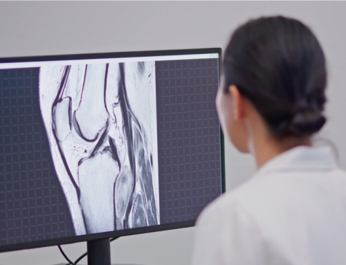 Incredible Results with AI in Medical Imaging
